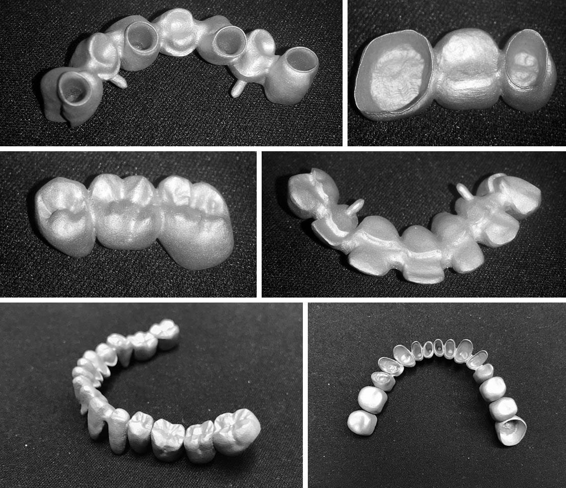 Medical metal 3D printing solutions. / 醫療金屬 3D 列印方案。